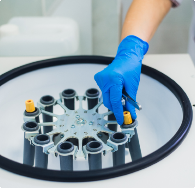 Platelet-rich plasma: what is it and what is the PRP technique used for?