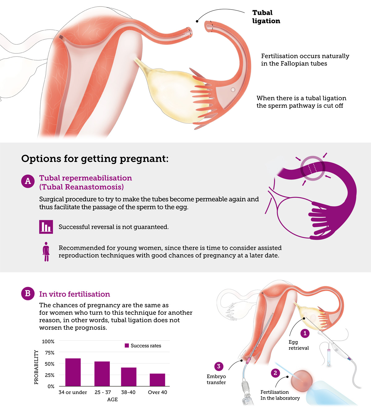 Pregnancy is possible after a tubal ligation